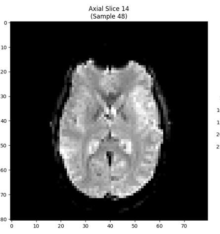 fMRI Analysis of Visual Motion Stimuli