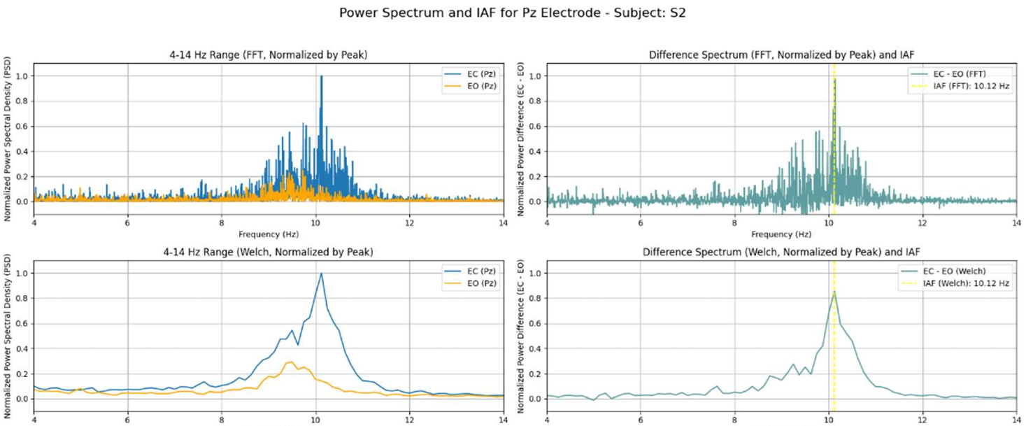 EEG and Individual Alpha Frequency thumbnail